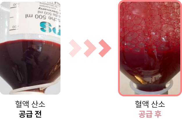 재투여 이미지